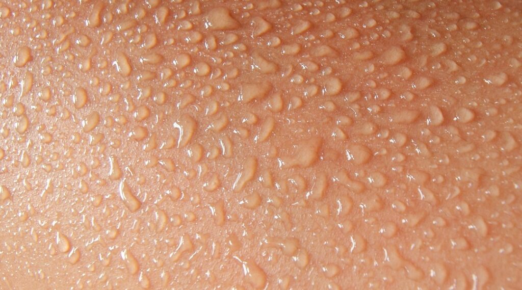 Stoma und Hitze
