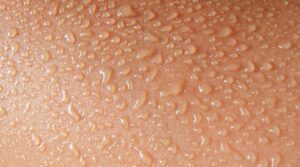 Stoma und Hitze