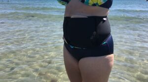 Schwimmgürtel, Sschwimmen mit Stoma