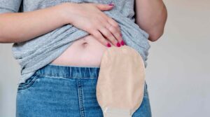 Stoma Hygiene