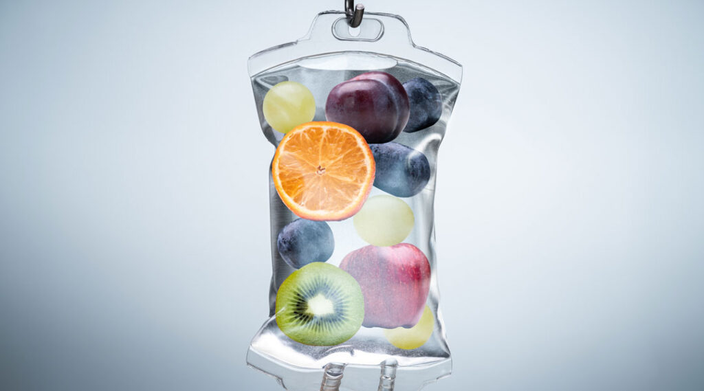 Infusion, Mangelernaehrung, Nährlösung, parenterale Ernährung