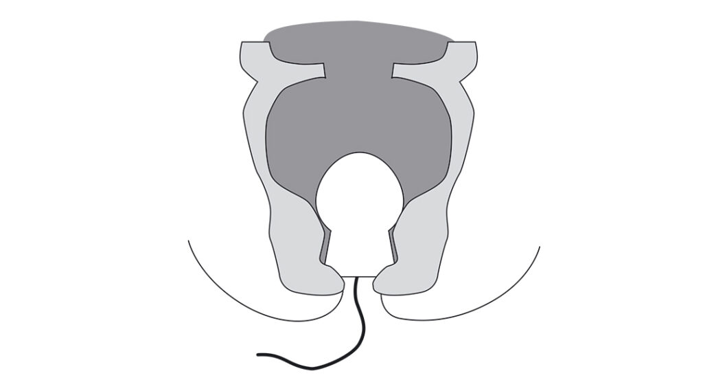 Analtampon, aufsaugende Inkontinenz