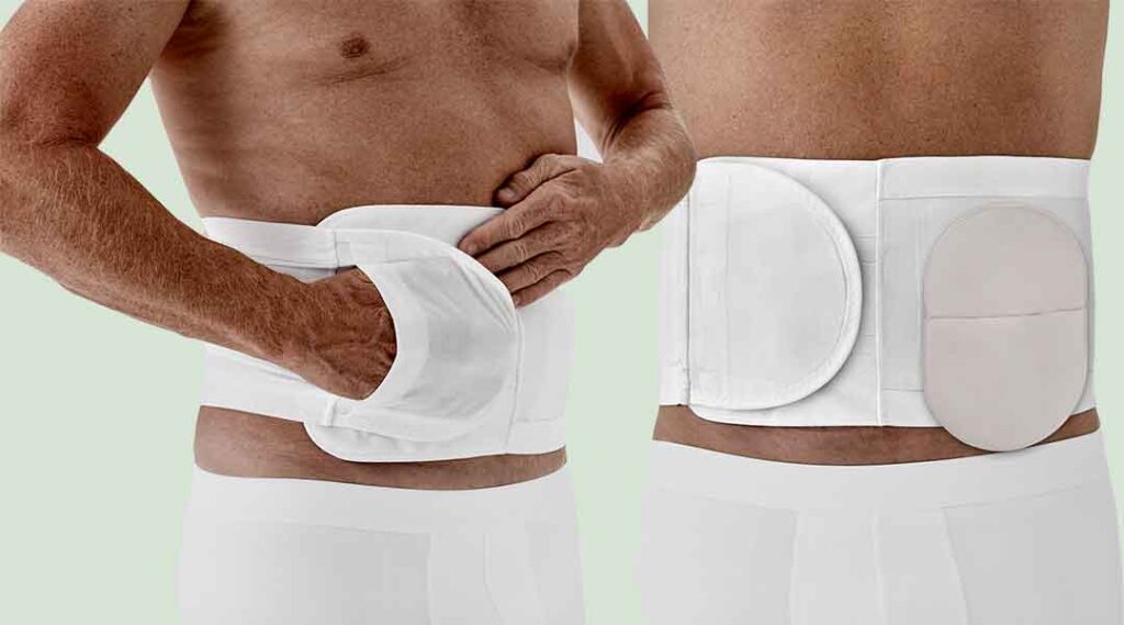 Coloplast Brava Bandage, Stomabandage
