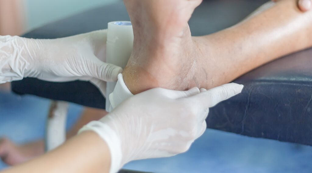 Behandlung diabetischer Fuß, diabetisches Fußsyndrom