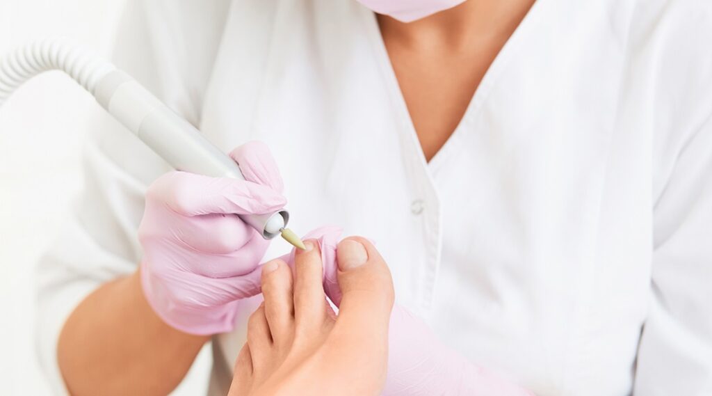 Medizinische Fußpflege, diabetisches Fußsyndrom