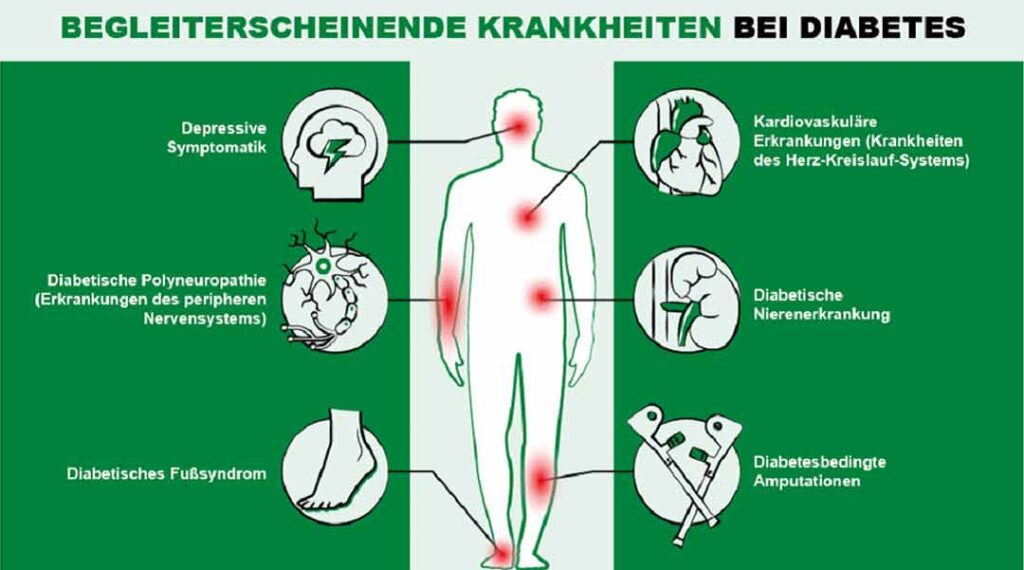 Diabetes Begleiterkrankungen Grafik